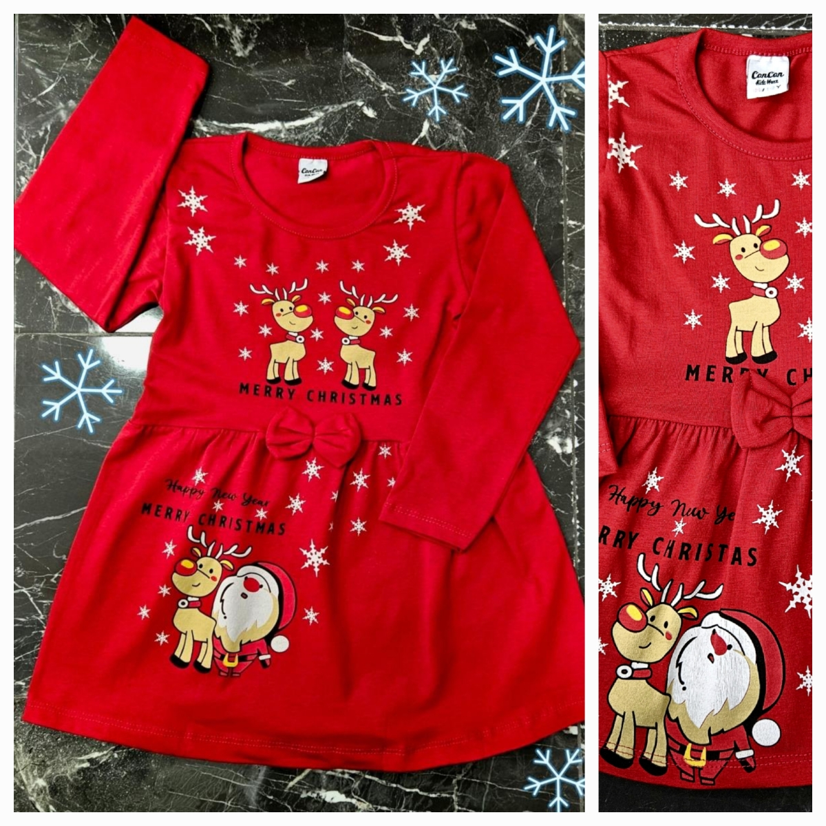 ELBISE NOEL GEYIK BAS U.KOL